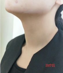 -南京健丽·去眼袋医疗美容机构