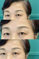 -杨益美学·野生眉半永久纹眉发际线