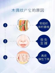 -安吉拉青春化管理中心