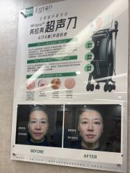-深圳鹏爱秀琪医疗美容医院