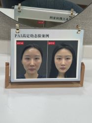-深圳鹏爱秀琪医疗美容医院