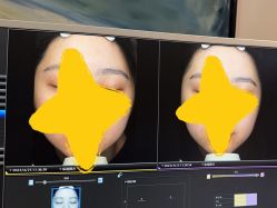 -苑苑vbeauty科技美容SPA