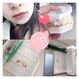 带牙套5个多月了，变化还是挺明显的