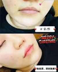 -SKINIST丽铂医疗美容