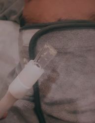 -SKIN79皮肤管理中心