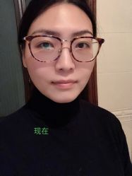 -维纳斯专业减肥