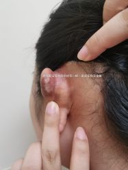 体验后-正璞医疗美容·皮肤修复·微整注射