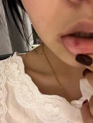 -More摩尔医美の注射线雕光电中心