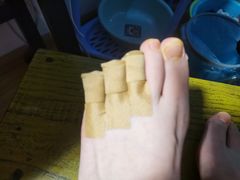 -新甲连锁灰指甲·甲沟炎·鸡眼(黑龙江路店)