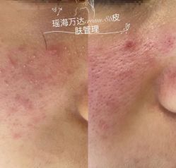 -Cream88颜皮肤管理中心