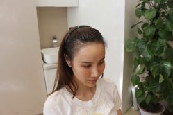 点击看大图 -大麦微针植发丨全国连锁