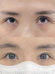 -丰联丽格医疗美容·联合丽格眼整形中心