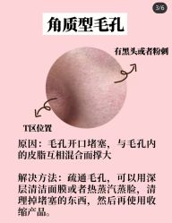 -蕾特恩专业祛痘·皮肤管理
