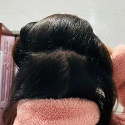 点击看大图 -雍禾植发