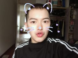 -大麦微针植发丨全国连锁