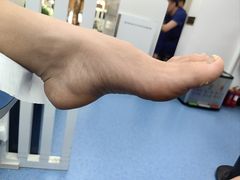 -Andrew指甲专科灰指甲·甲沟炎矫正·3D步态矫形鞋垫定制(上海法华镇路旗舰店)
