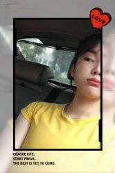 -大麦微针植发全国连锁