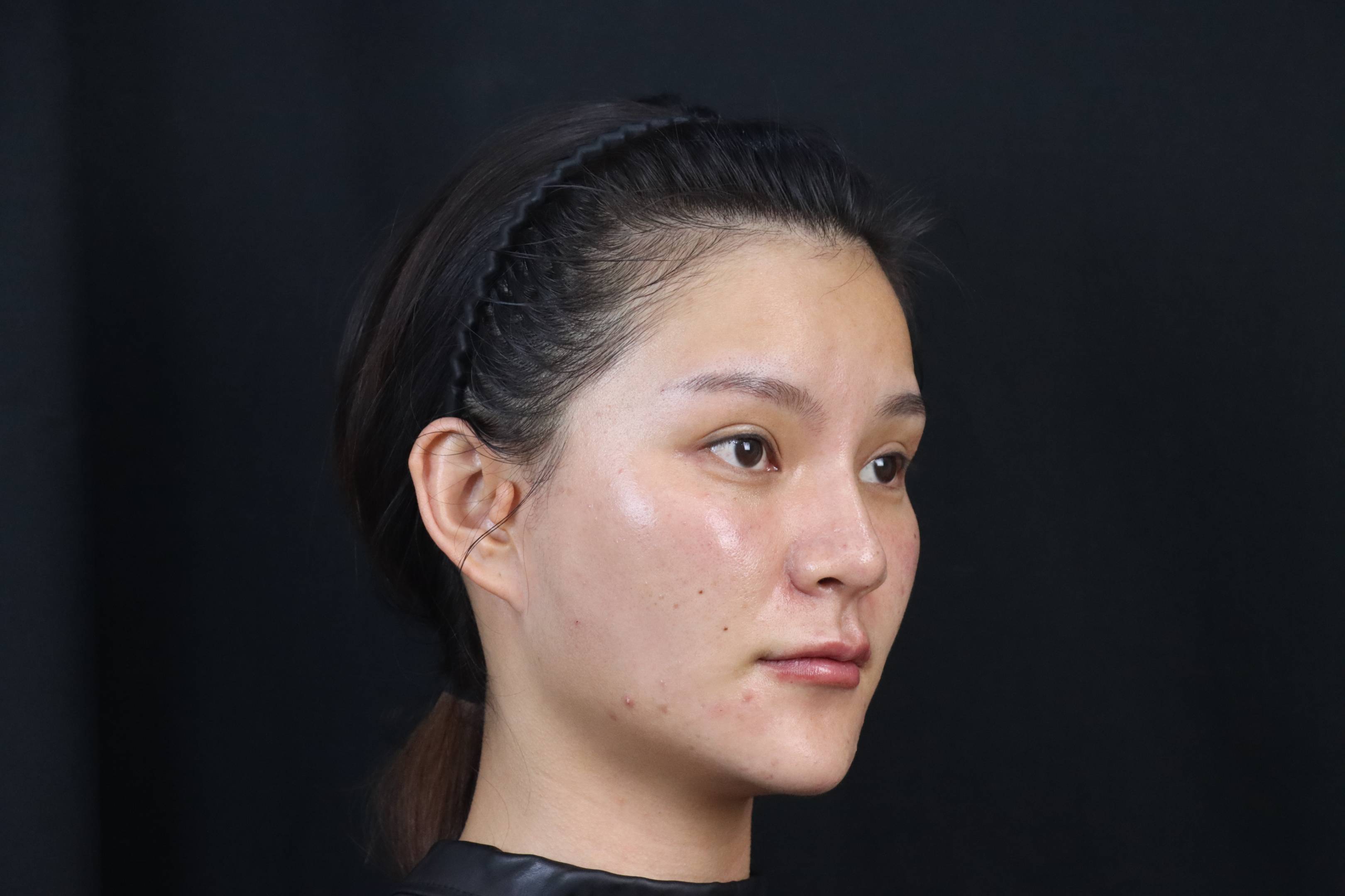 面颊凹陷 大众点评
