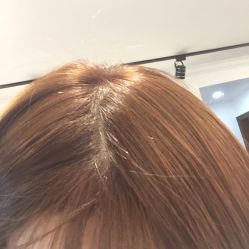 picture-思密达