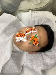 -悟空祛痘·诺奖技术专业店