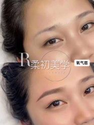 -RC半永久纹眉纹发际线