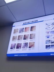 -蕾特恩专业祛痘