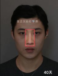 -北京米扬丽格医疗美容·联合丽格鼻整形中心