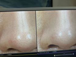 -苑苑vbeauty科技美容SPA