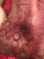 -兰派国际美容养生SPA