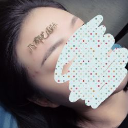 点击看大图 -郡艺医疗美容·微整·眼鼻吸脂