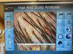 -熙朵美学植发·连锁品牌