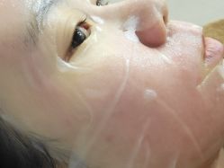 体验后-伊丽莎白医疗美容