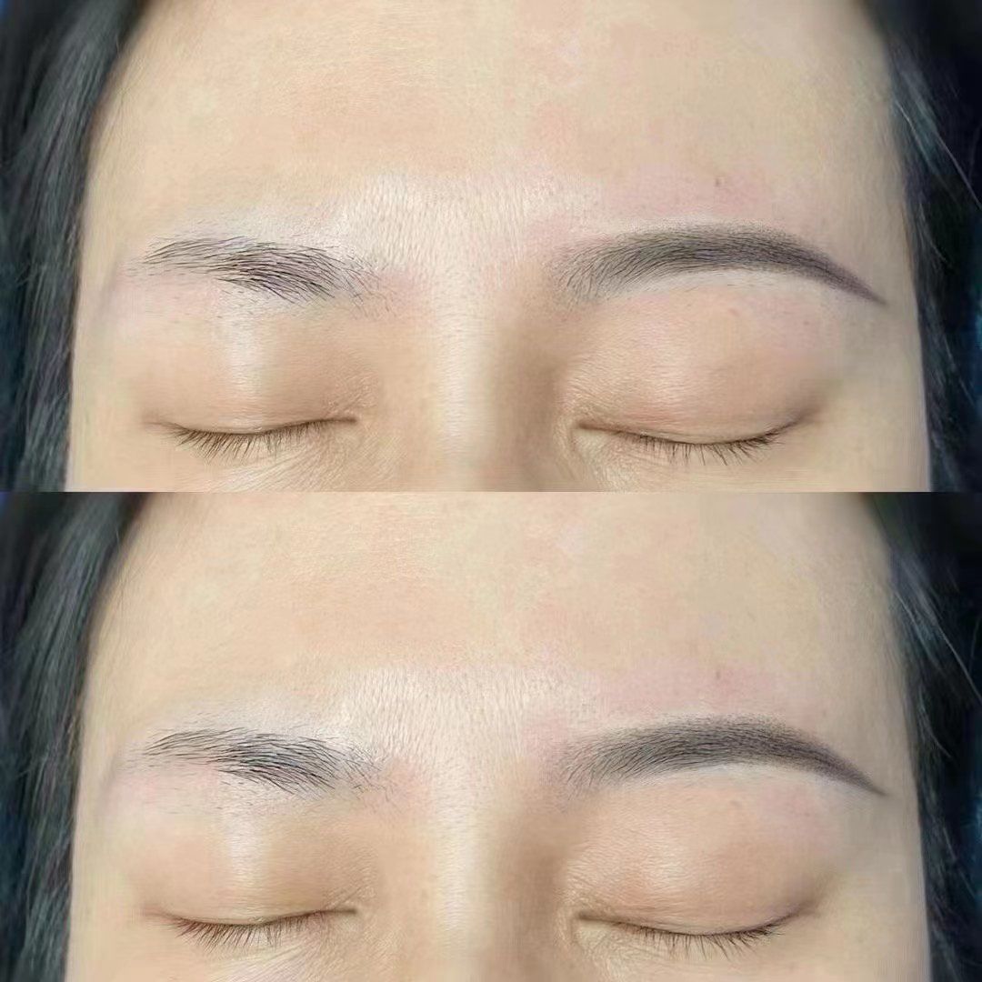 雾眉对比图