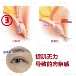 -丰联丽格医疗美容·联合丽格眼整形中心