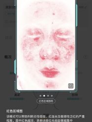 点击看大图 -SKINIST丽铂医疗美容