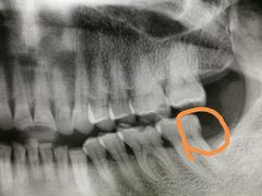 -上海陈守平口腔诊所