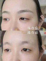 点击看大图 -西施无菌半永久纹绣眉眼影唇轻增发纹发际线