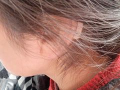 -自然之声助听器·呼吸机(公园路店)