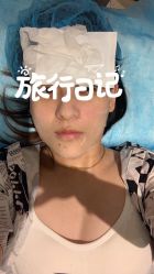 体验后-苏州卫康美容医院