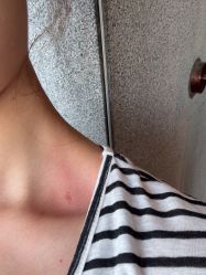 -苑苑vbeauty科技美容SPA