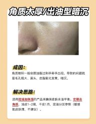 -苗方清颜痘肌研究所