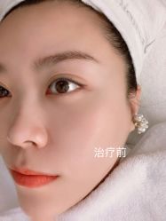 -纯粹医美