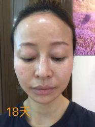 -元熙兰积皮肤管理