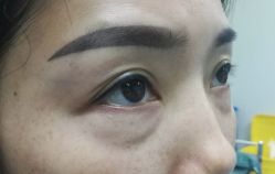 -天津健丽·去眼袋医疗美容机构