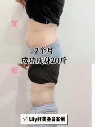 -Lily纤美·科技减脂中心