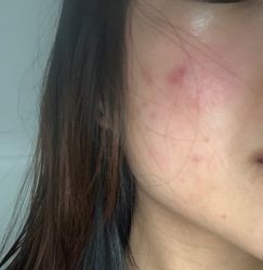 体验前-依萱绮医疗美容