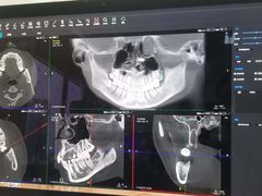 -Dr.Z dental仁康种植矫正中心