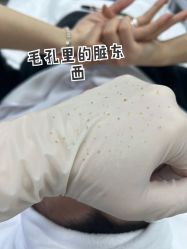 -元熙兰积皮肤管理