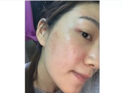 -苗方清颜痘肌研究所