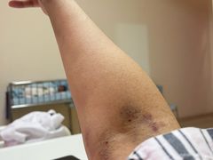 -首都医科大学附属北京同仁医院(南区)